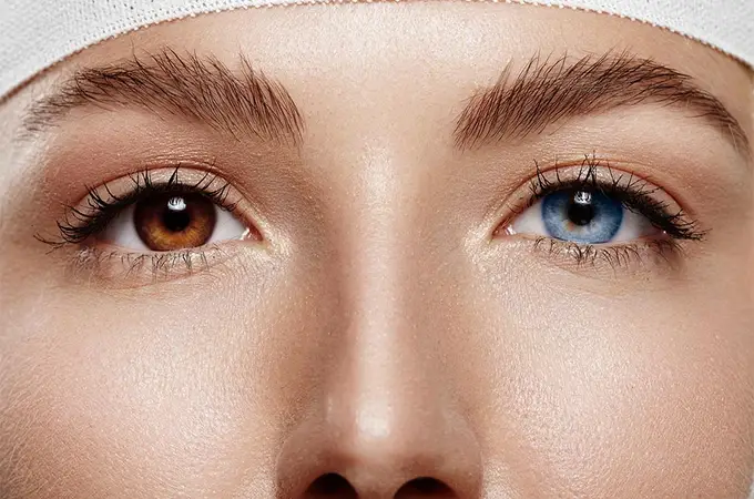 Cambiar el color de ojos: la operación estética viral que escandaliza a los expertos