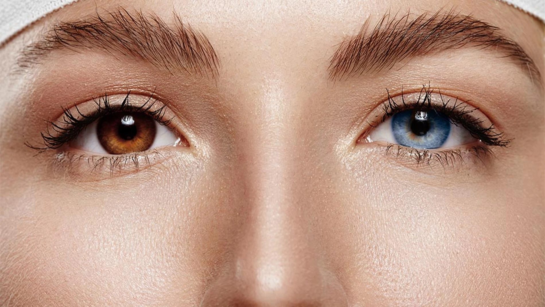 Cambiar el color de ojos: la operación estética viral que escandaliza a los  expertos