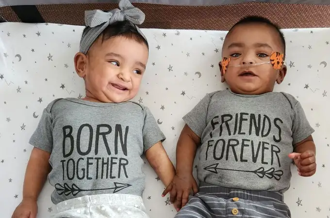 Casi dejan morir a los gemelos más prematuros del mundo: nacieron con 22 semanas y ahora cumplen 1 año