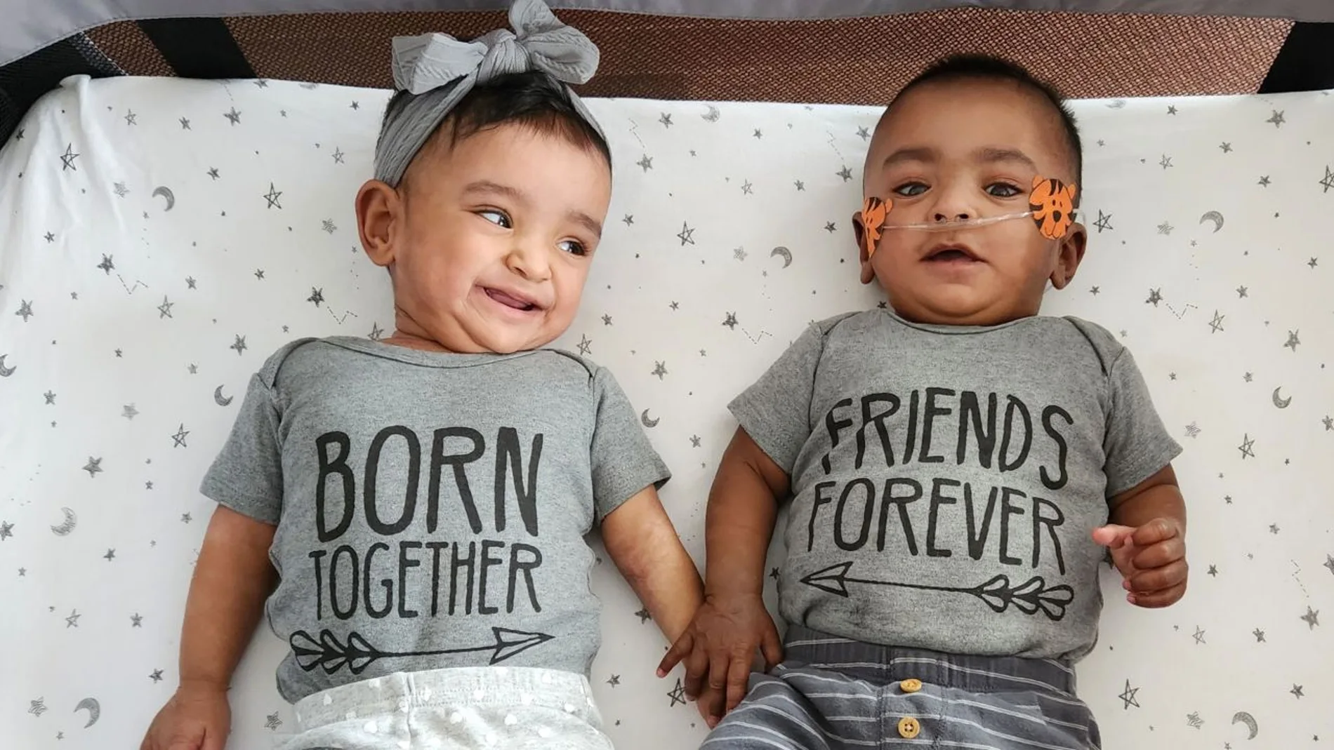 los gemelos más prematuros del mundo nacieron en Canadá
