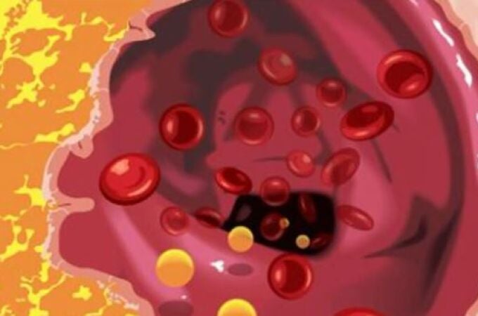 La EMA alerta de dos nuevos efectos secundarios graves en fármacos que reducen el colesterol