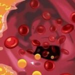 La EMA alerta de dos nuevos efectos adversos graves en fármacos que reducen el colesterol