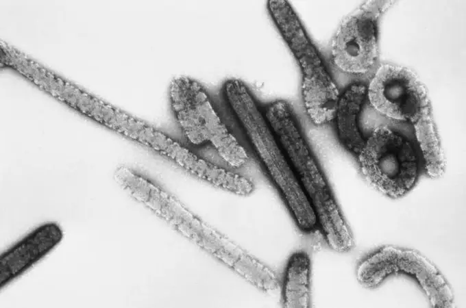 La OMS se vuelca para contener los nuevos casos del virus de Marburgo en África