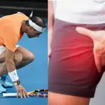  Claves para entender la dolorosa lesión de Rafa Nadal: ¿Qué es y como se trata?