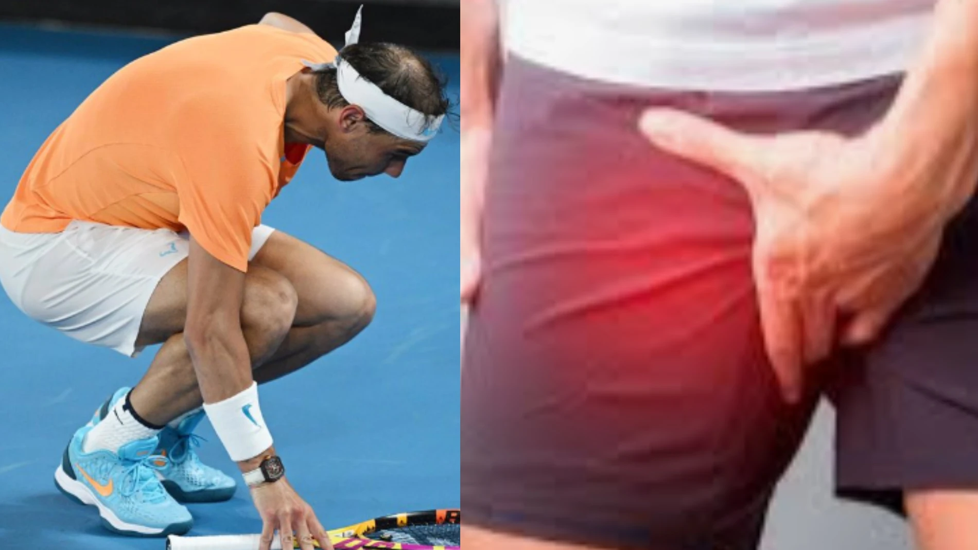  Claves para entender la dolorosa lesión de Rafa Nadal: ¿Qué es y como se trata?