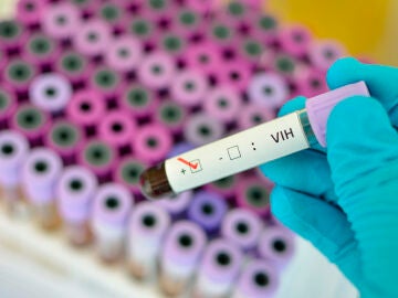 El avance del VIH se produce en el intestino, según un estudio