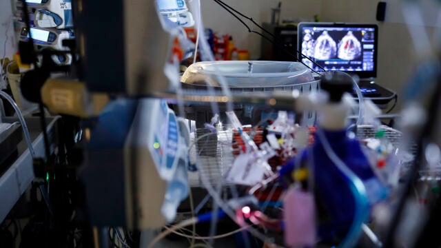 La placenta artificial de BCNatal es el primer prototipo experimental que se desarrolla en Europa 
