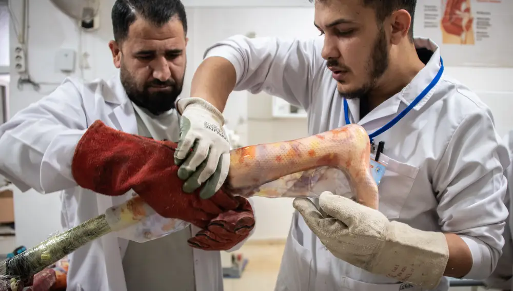 Día Mundial del Refugiado. Médicos y doctores sirios junto con refugiados y prótesis por miembros amputados por los conflictos bélicos. 