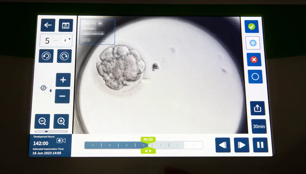 La pantalla de la incubadora con un sistema de inteligencia artificial que analiza las imágenes tomadas cada 5 minutos a los &quot;8 ó 10 embriones que podemos tener cultivando&quot;, explica Leyre Herrero, coordinara de Embriología del Instituto Bernabéu de Madrid