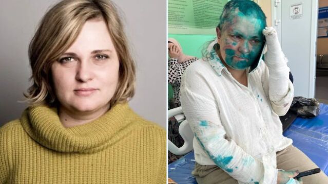 La periodista rusa Elena Milachina en el hospital tras ser atacada en Grozni