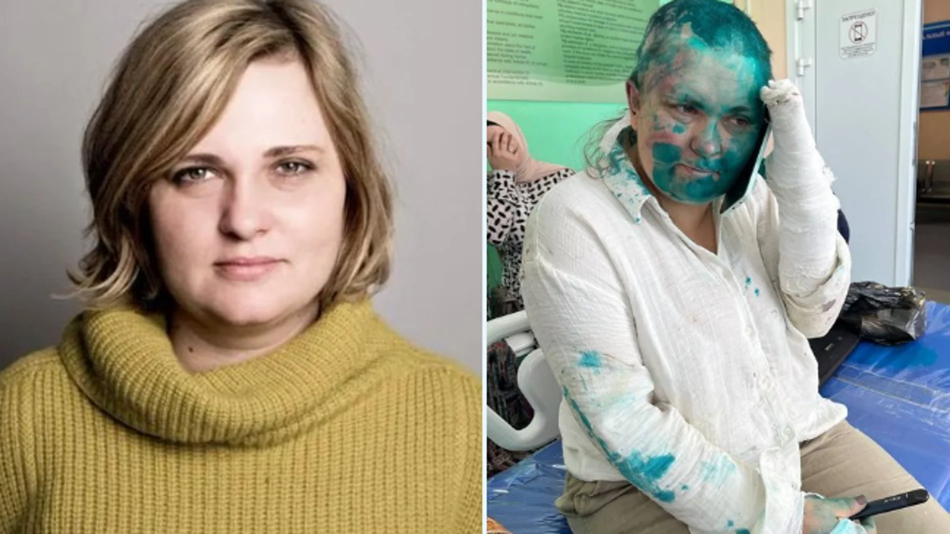 La periodista rusa Elena Milachina en el hospital tras ser atacada en Grozni