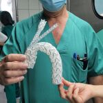 Detalle dispositivo de doble rama para un aneurisma implantado en el HUC