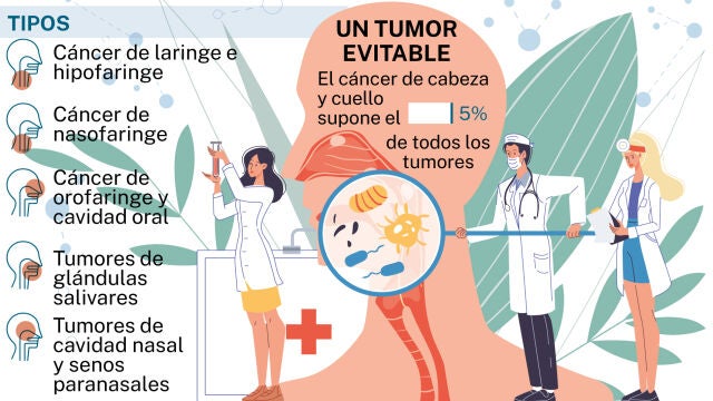 Cáncer de cabeza y cuello