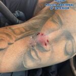 Una mujer muerde a dos policías cuando iba a ser detenida por agredir a su marido con un cuchillo en Cádiz