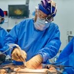 Los médicos implantan un riñón de cerdo en el cuerpo de Maurice Miller, en julio de 2023