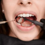 El revolucionario fármaco para los dientes podría estar a la venta en 2030