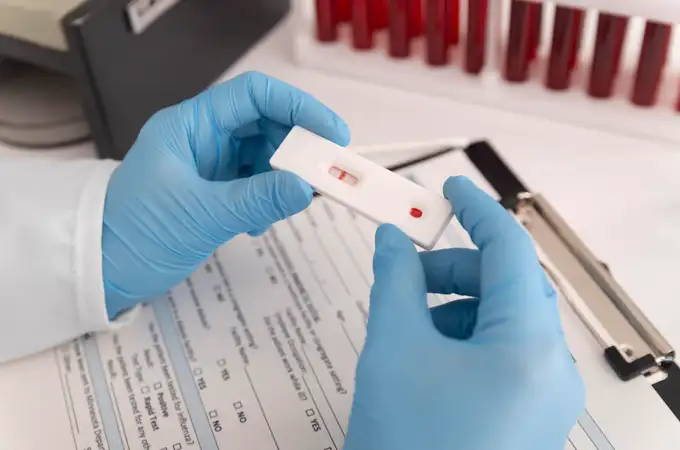 Los test selectivos de VIH, mejor que los voluntarios