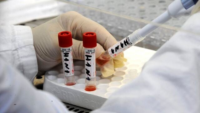 Pruebas para la gripe porcina en un laboratorio