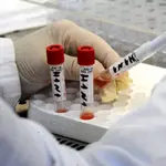 Pruebas para la gripe porcina en un laboratorio