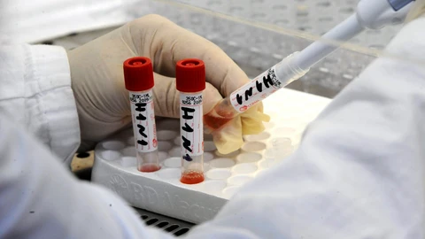 Pruebas para la gripe porcina en un laboratorio