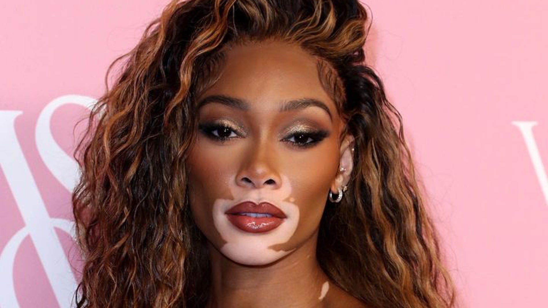 Modelo De Vit ligo La Incre ble Historia De Winnie Harlow La Modelo Modelo De Vit ligo La Incre ble Historia De Winnie Harlow La Modelo