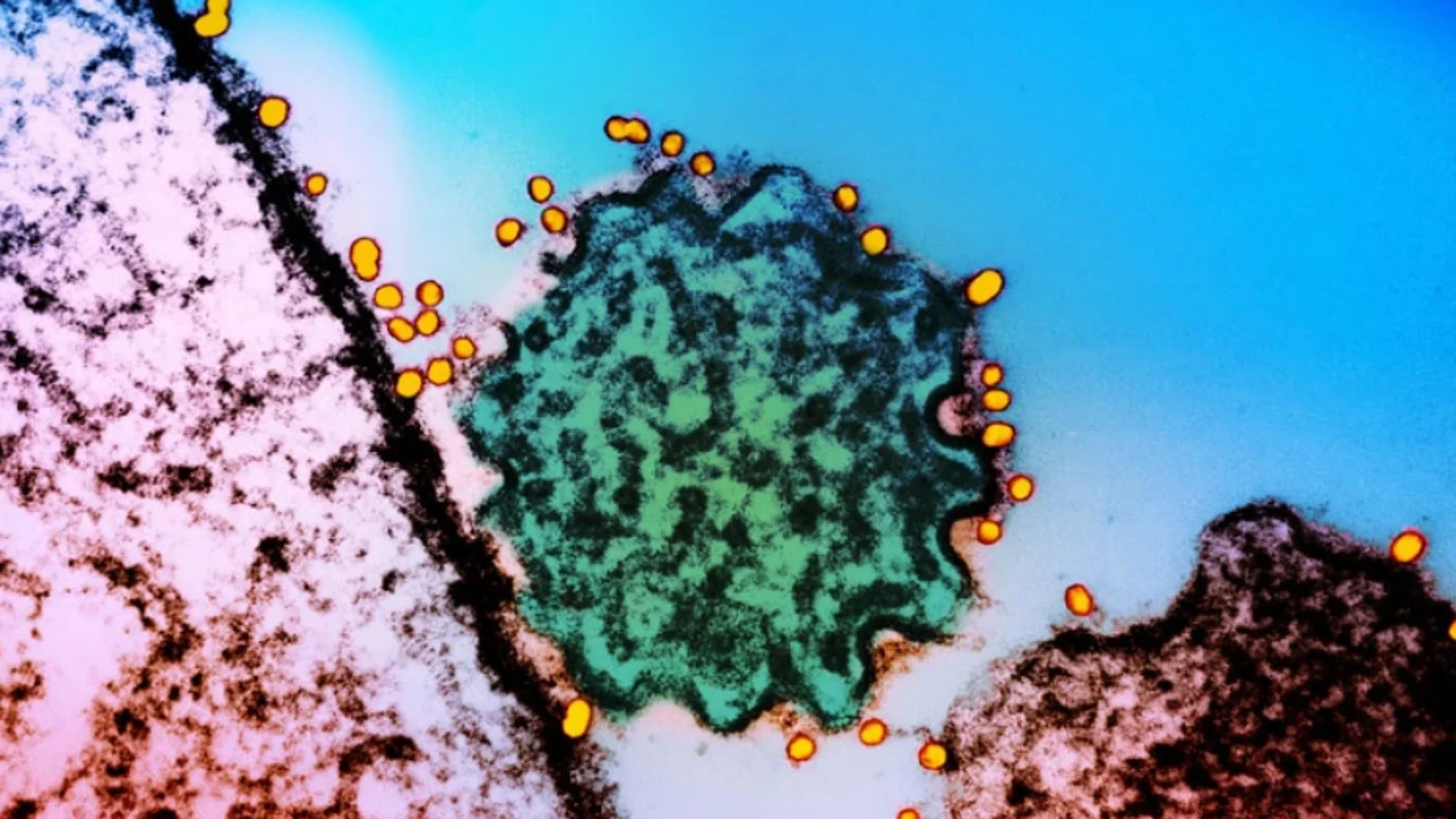 Virus Nipah