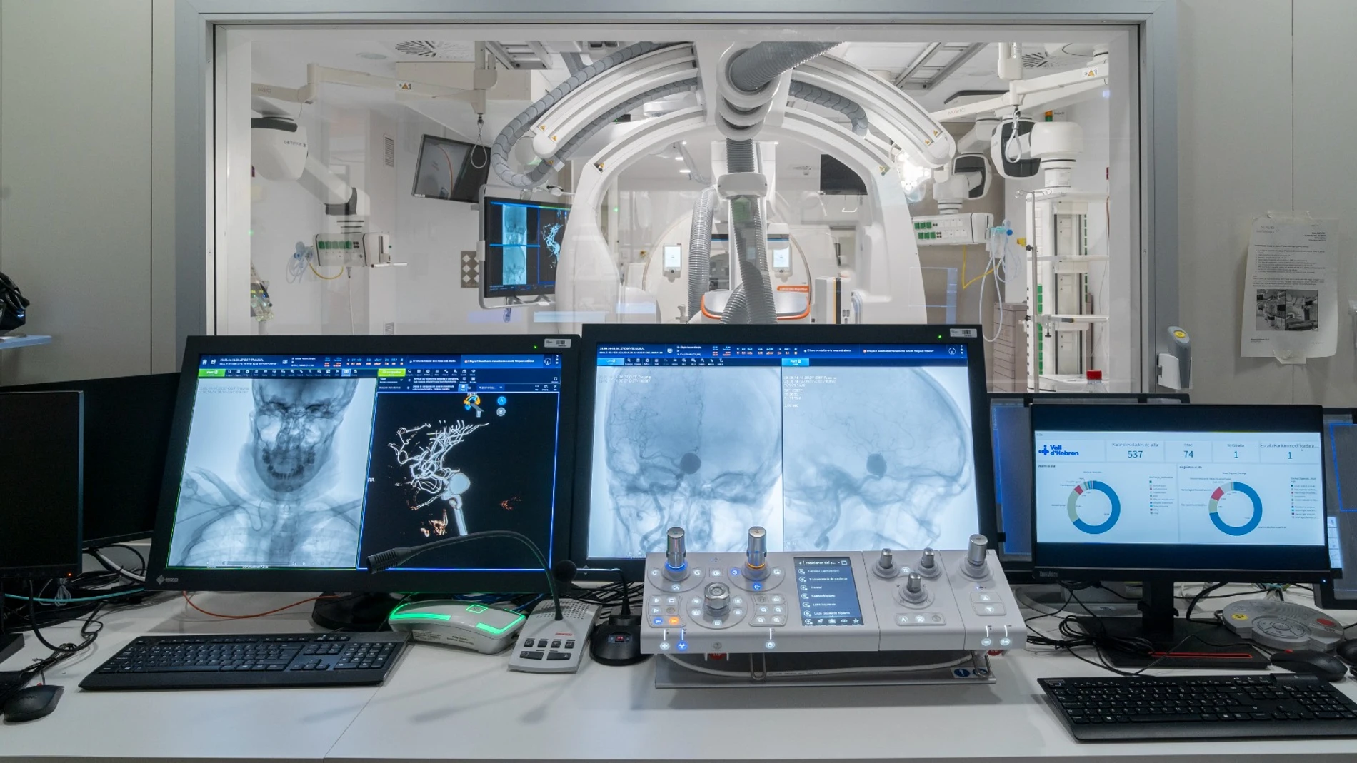 La sala de angiografía de One Step Ictus concentra todo el abordaje del Ictus