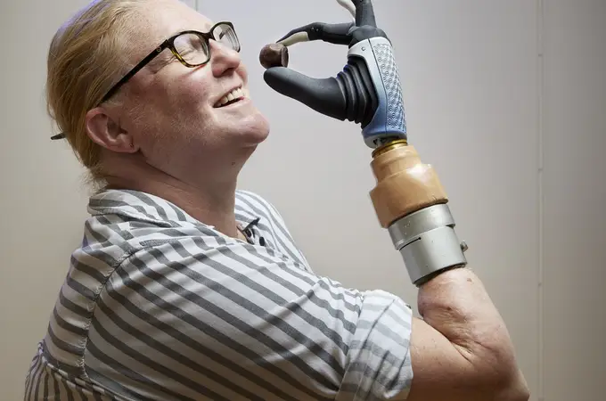 Logran la fusión entre humano y máquina mediante este brazo biónico