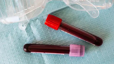 Un estudio reveló que el secreto de la longevidad podía estar en la sangre