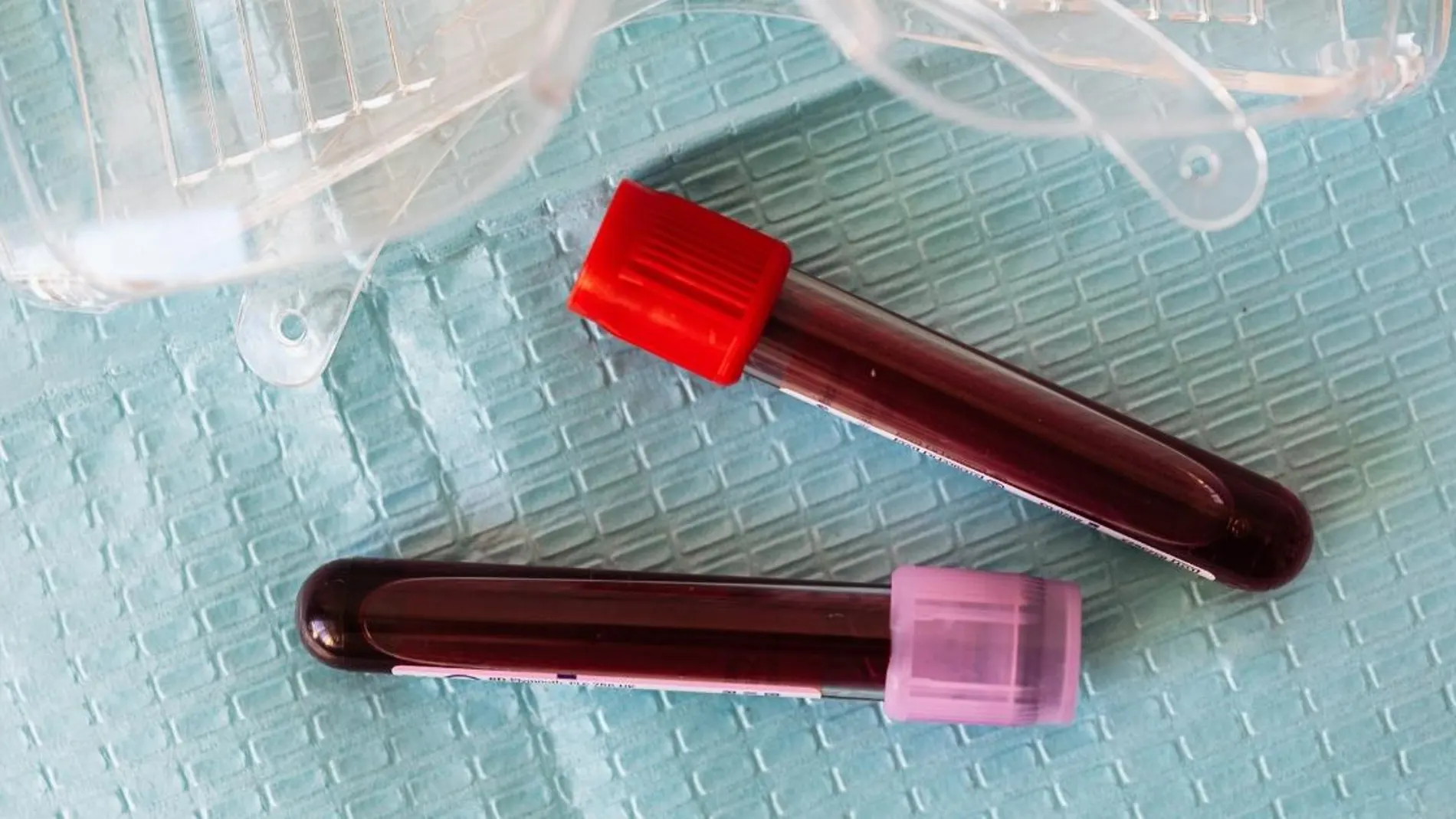 Marcadores bioquímicos que muestran la longevidad en la sangre