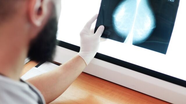 El tratamiento de cáncer de mama ha cambiado su paradigma con más curaciones, supervivencia y calidad de vida