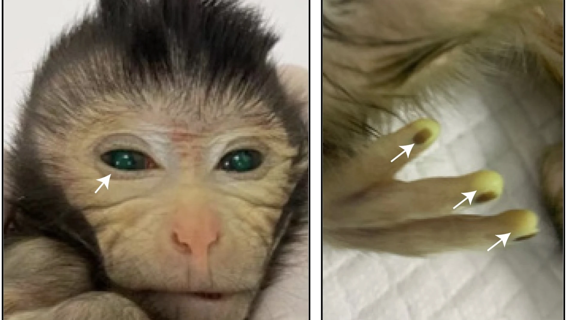 Fotografía del macaco quimérico donde se ven las células fluorescentes implantadas