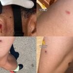 Sucesos.- La Guardia Civil investiga a tres jóvenes por disparar bolas de airsoft a ciclistas en el Puerto del Garruchal