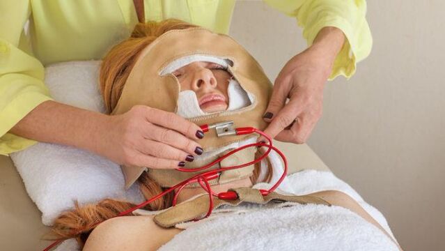 Máscara facial "Hannibal Lecter": ¿Es seguro este polémico tratamiento de belleza?