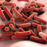 La bacteria causante de esta enfermedad es la Mycobacterium tuberculosis