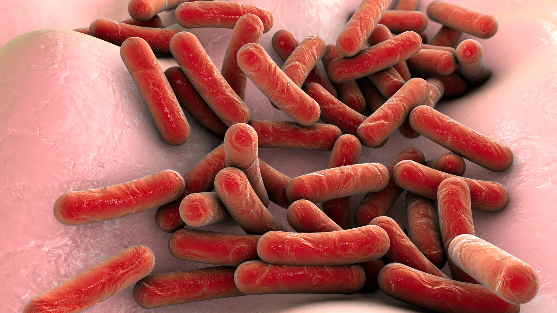 La bacteria causante de esta enfermedad es la Mycobacterium tuberculosis