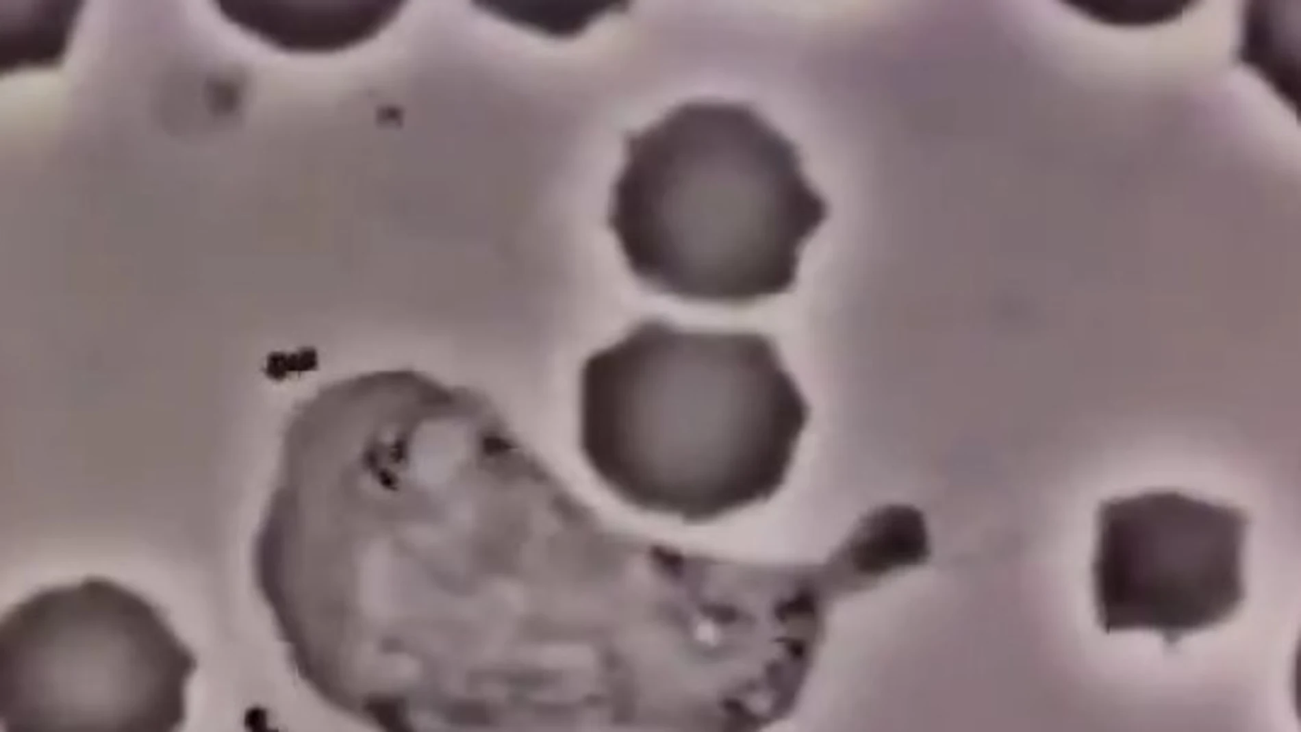 El vídeo que muestra qué ocurre en tu sangre cuando entra una bacteria