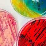 Cultivos de bacterias en placas de Petri