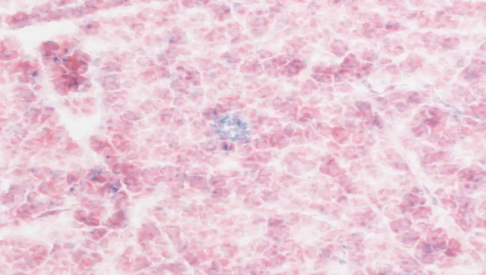 Las células senescentes (azul) se acumulan a medida que envejecemos. Las células CAR-T se pueden programar para buscarlas y destruirlas. La imagen de arriba muestra muestras de tejido pancreático sano de un ratón viejo tratado con células T-CAR cuando era pequeño