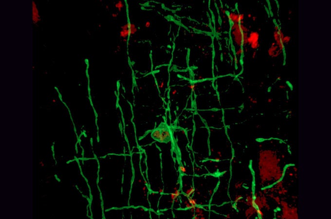 Un oligodendrocito mielinizando a una neurona