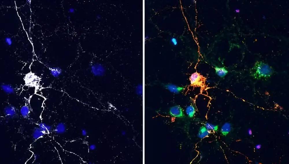Las neuronas que expresan proteínas Lag-3 (gris/blanco) captan proteínas Tau (rojo)