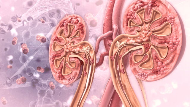 Fibrosis renal