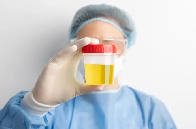 Un medicamento 'inofensivo' da positivo en los test de drogas en orina, alerta un estudio