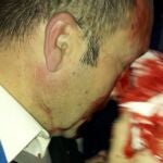 Un funcionario que sufrió heridas en un ojo en la cárcel de Morón durante una manifestación por la equiparación salarial