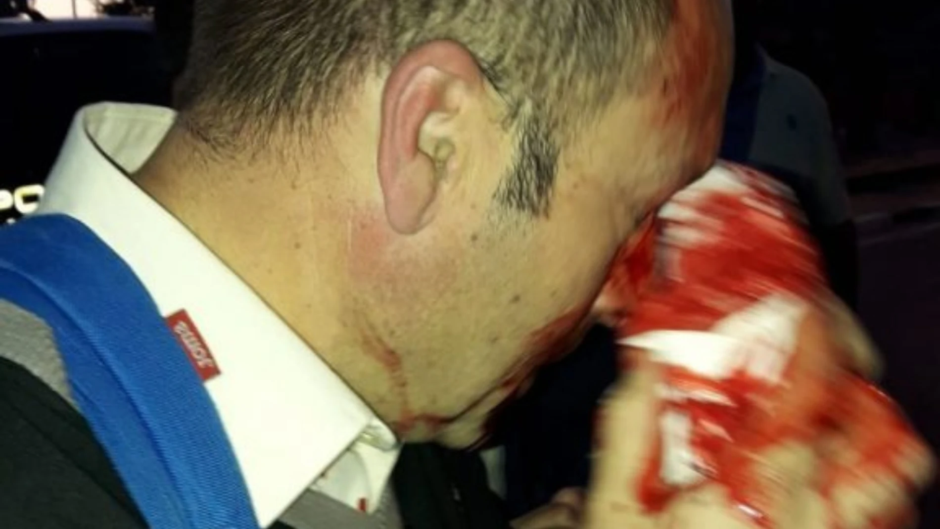 Un funcionario que sufrió heridas en un ojo en la cárcel de Morón durante una manifestación por la equiparación salarial