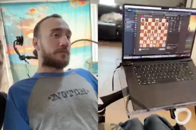 Elon Musk comparte un vídeo del primer paciente de Neuralink que es capaz de mover las piezas de ajedrez con la mente
