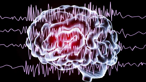 Su causa más común es la epilepsia, pero también la fiebre alta, la exposición a luces parpadeantes o a los tumores