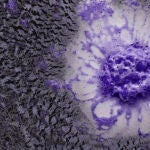 Representación de una célula con espuma morada