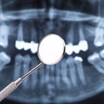 Medicina regenerativa en odontología