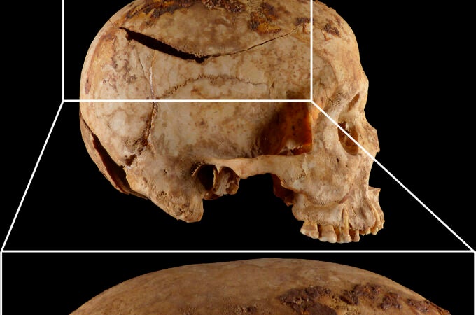 Imagen compuesta de uno de los cráneos estudiados, procedente de la necrópolis de Qubbet el-Hawa